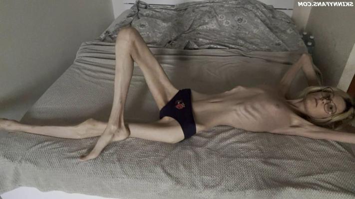 KSENIA anorexique maigre maigre maman Duenn Knochig Bones
