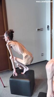 Denisa anorexique maigre maigre mageur Duenn Knochig Bones