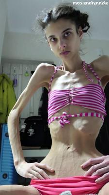 Ariadne anorexic skinny fragile mager duenn knochig bones 