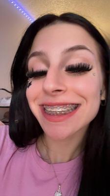 yr old braceface slut