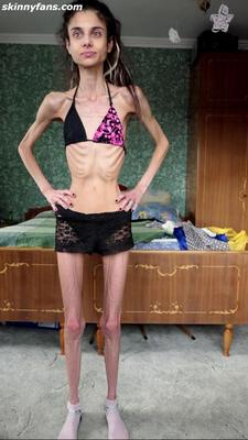 Ariadne anorexic skinny fragile mager duenn knochig bones 